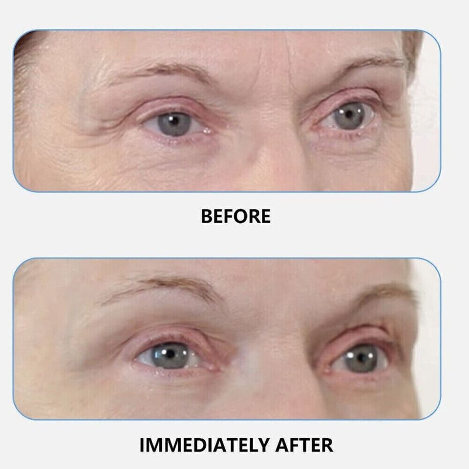 Instant FIRMx - Temporary Eye Cream Tightener